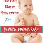 The Best Diaper Rash Cream for Severe Diaper Rash | SimplePureBeauty.com #diaperrash #rash #diapercream
