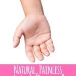 After trying all of the conventional wart removal remedies, we finally found this natural, painless wart removal for kids. It worked on regular warts, flat warts, and even plantar warts! #wartremoval #natural